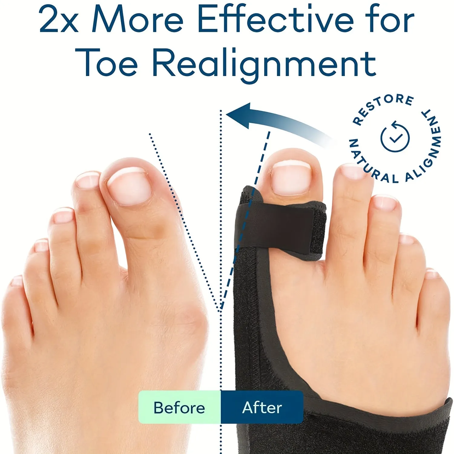 Toe Separator For Bunion Relief Adjustable Bunion Corrector Support Brace with Built-in Metal Plate for Men and Women 1 pair