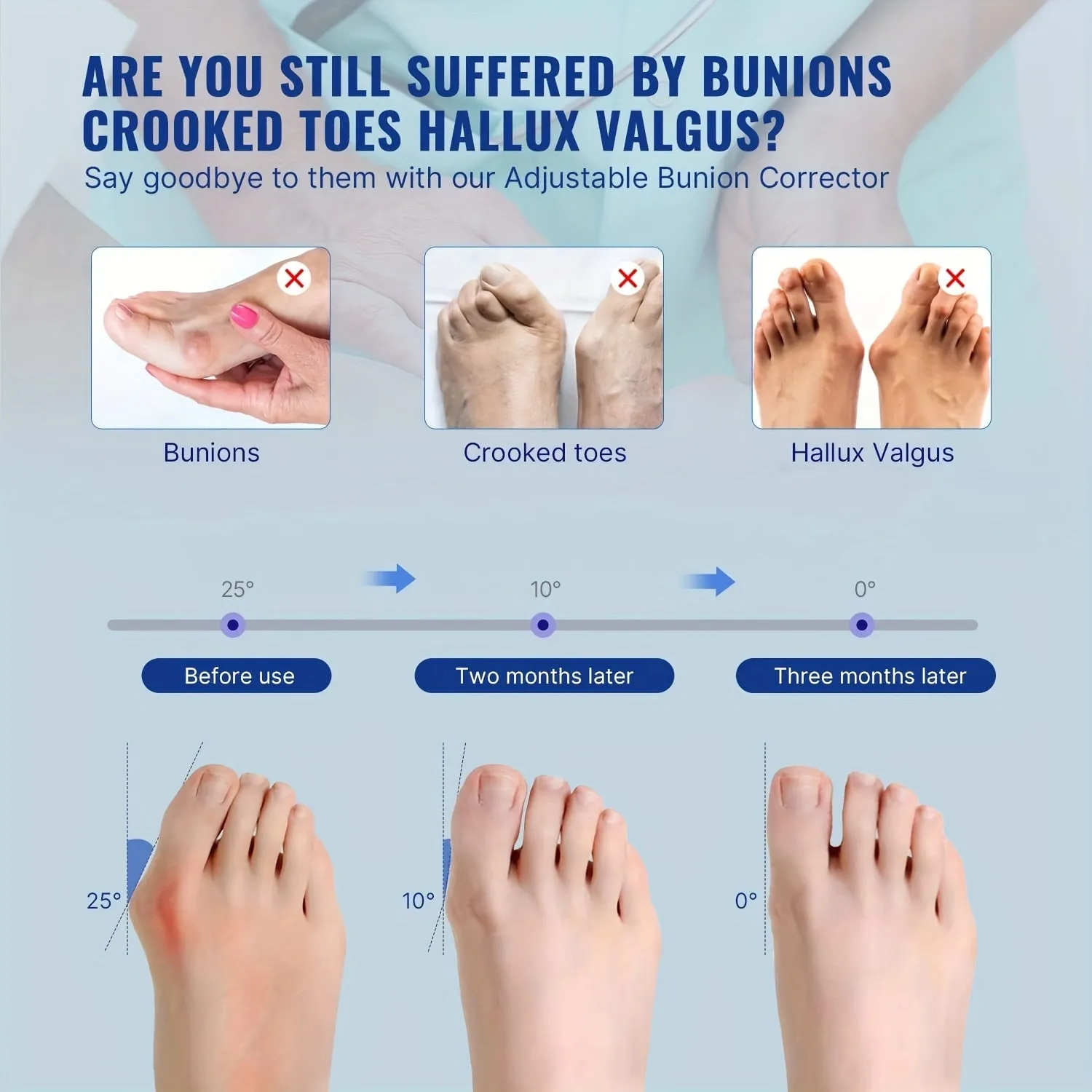 Toe Separator For Bunion Relief Adjustable Bunion Corrector Support Brace with Built-in Metal Plate for Men and Women 1 pair